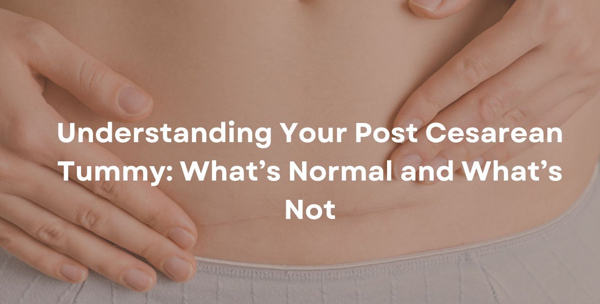 Understanding Your Post Cesarean Tummy: What’s Normal and What’s Not