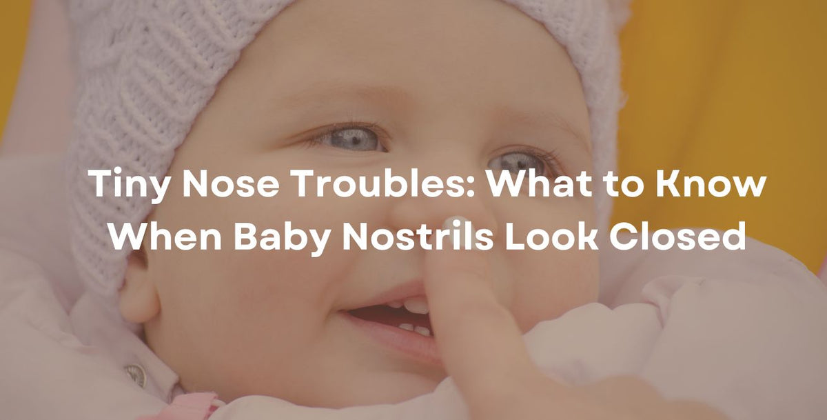 Tiny Nose Troubles: What to Know When Baby Nostrils Look Closed