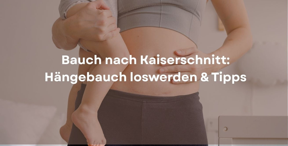 Bauch nach Kaiserschnitt: Hängebauch loswerden & Tipps