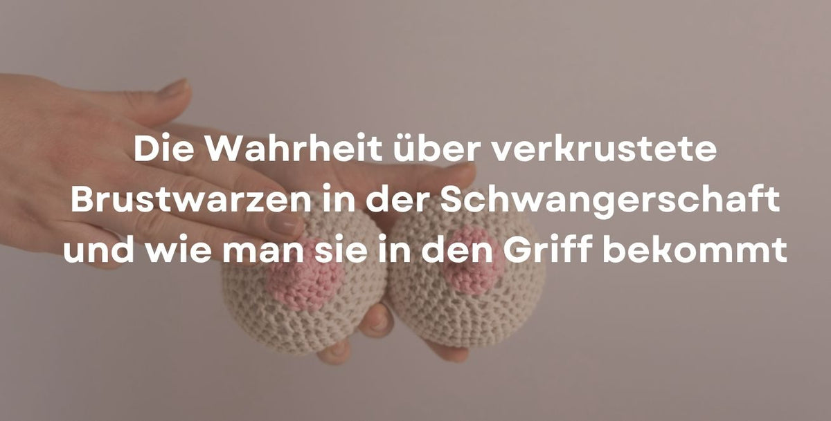 Die Wahrheit über verkrustete Brustwarzen in der Schwangerschaft und wie man sie in den Griff bekommt