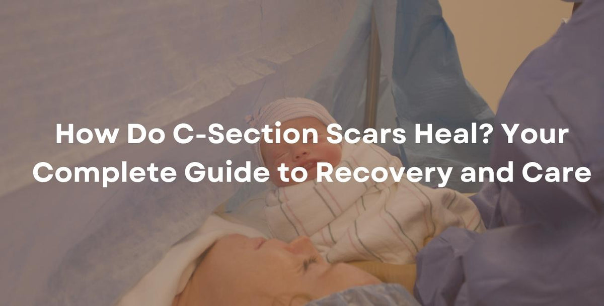 How Do C-Section Scars Heal? Your Complete Guide to Recovery and Care