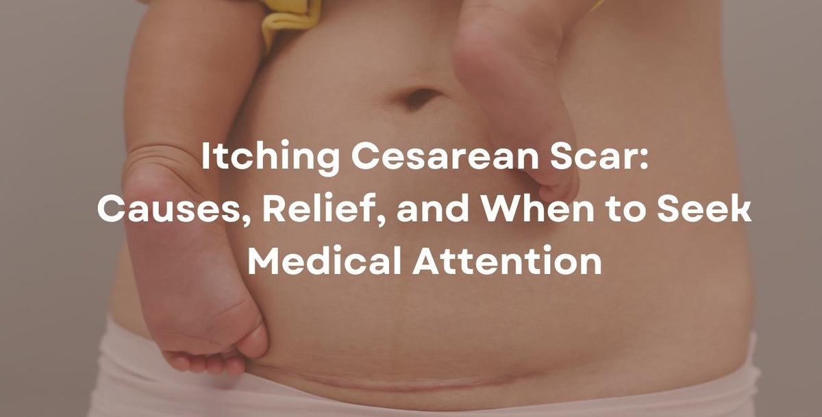 Itching Cesarean Scar: Causes, Relief, and When to Seek Medical Attention