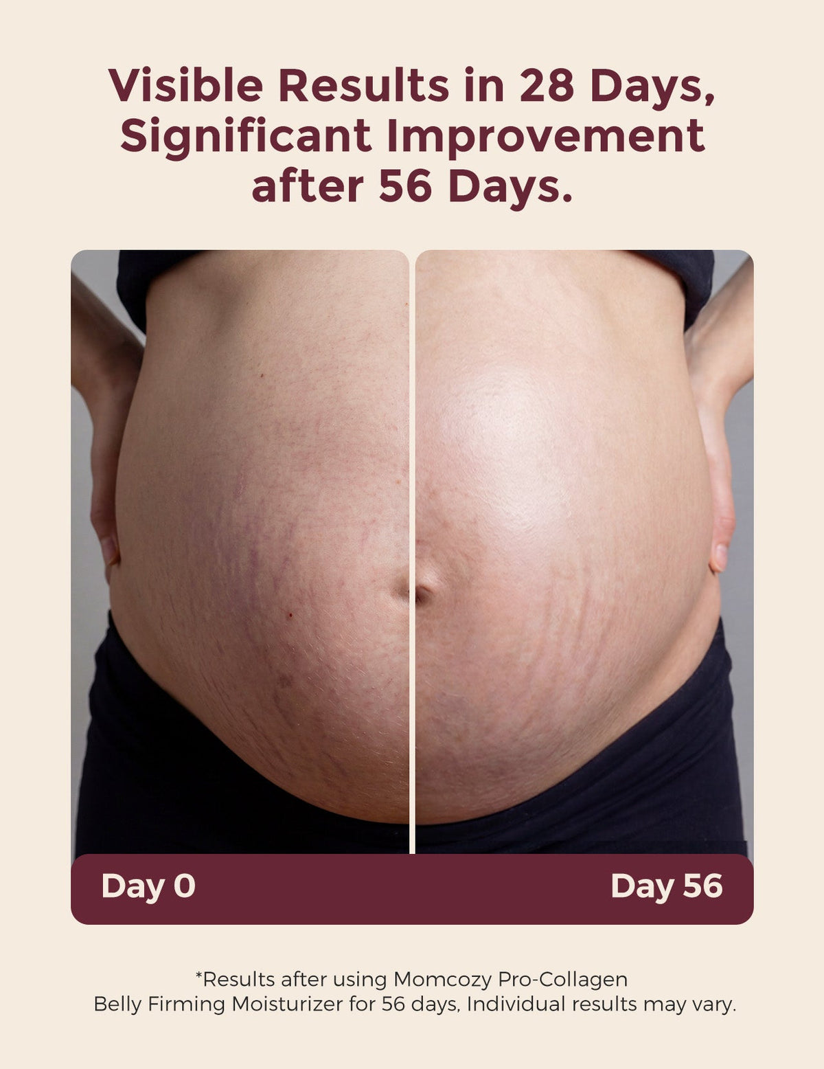 Momcozy Pro-Collagen Belly Firming Moisturizer